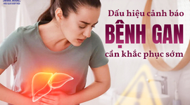 Các dấu hiệu cảnh báo bệnh gan và cách khắc phục hiệu quả