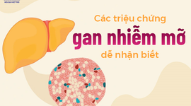 Các triệu chứng gan nhiễm mỡ dễ nhận biết 