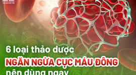 6 loại thảo dược ngăn ngừa cục máu đông nên dùng ngay