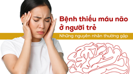 Bệnh thiếu máu não ở người trẻ: Những nguyên nhân thường gặp