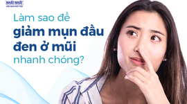 Làm sao để giảm mụn đầu đen ở mũi nhanh chóng?