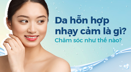 Da hỗn hợp nhạy cảm là gì? Chăm sóc như thế nào? 