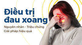 Điều trị đau xoang: Nguyên nhân – Triệu chứng – Giải pháp hiệu quả