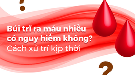 Búi trĩ ra máu nhiều có nguy hiểm không? Cách xử trí kịp thời