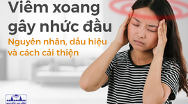 Viêm xoang gây nhức đầu: Nguyên nhân, dấu hiệu và cách cải thiện