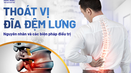 Thoát vị đĩa đệm lưng: Nguyên nhân và các biện pháp điều trị