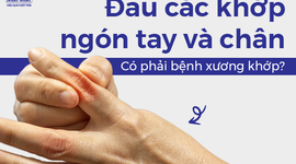 Đau các khớp ngón tay và chân: Có phải bệnh xương khớp?