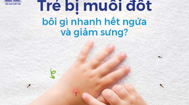 Trẻ bị muỗi đốt bôi gì nhanh hết ngứa và giảm sưng?