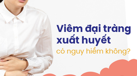 Viêm đại tràng xuất huyết có nguy hiểm không?