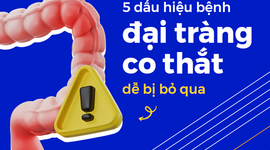 5 dấu hiệu bệnh đại tràng co thắt dễ bị bỏ qua