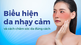 Biểu hiện da nhạy cảm và cách chăm sóc da đúng cách