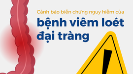 Cảnh báo biến chứng nguy hiểm của bệnh viêm loét đại tràng