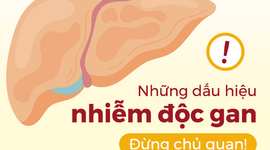 Những dấu hiệu nhiễm độc gan: Đừng chủ quan!