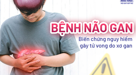 Bệnh não gan: Biến chứng nguy hiểm gây tử vong do xơ gan