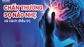 Nhận biết triệu chứng chấn thương sọ não nhẹ và cách điều trị