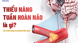 Thiểu năng tuần hoàn não là gì? Các biện pháp dự phòng hiệu quả