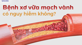 Tư vấn: Bệnh xơ vữa mạch vành có nguy hiểm không?