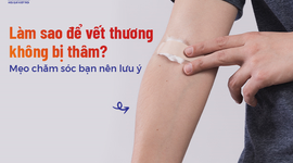 Làm sao để vết thương không bị thâm? Mẹo chăm sóc bạn nên lưu ý