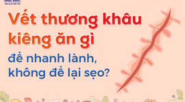 Vết thương khâu kiêng ăn gì để nhanh lành, không để lại sẹo?