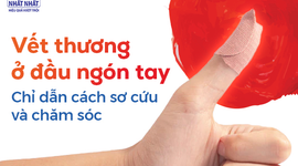 Vết thương ở đầu ngón tay: Chỉ dẫn cách sơ cứu và chăm sóc
