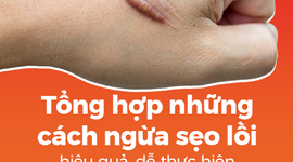Tổng hợp những cách ngừa sẹo lồi hiệu quả, dễ thực hiện