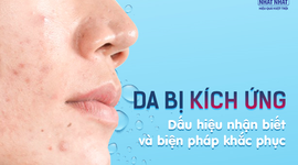 Da bị kích ứng: Dấu hiệu nhận biết và biện pháp khắc phục
