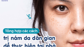 Tổng hợp các cách trị nám da dân gian dễ thực hiện tại nhà 