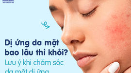 Dị ứng da mặt bao lâu thì khỏi? Những lưu ý khi chăm sóc da mặt dị ứng
