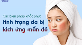 Các biện pháp khắc phục tình trạng da bị kích ứng mẩn đỏ