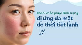 Cách khắc phục tình trạng dị ứng da mặt do thời tiết lạnh