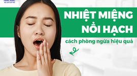 Nhiệt miệng nổi hạch: Chỉ dẫn cách phòng ngừa hiệu quả cao