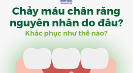 Chảy máu chân răng nguyên nhân do đâu? Khắc phục như thế nào?