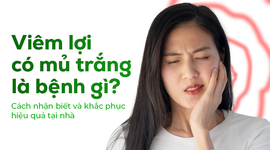 Viêm lợi có mủ trắng là bệnh gì? Cách nhận biết và khắc phục hiệu quả tại nhà