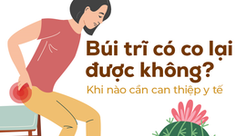 Búi trĩ có co lại được không? Khi nào cần can thiệp y tế