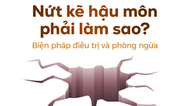 Nứt kẽ hậu môn phải làm sao? Biện pháp điều trị và phòng ngừa