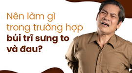 Nên làm gì trong trường hợp búi trĩ sưng to và đau?