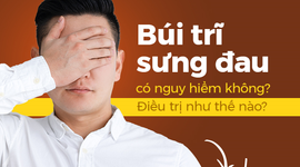 Búi trĩ sưng đau có nguy hiểm không? Điều trị như thế nào?