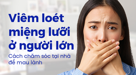 Viêm loét miệng lưỡi ở người lớn: Cách chăm sóc tại nhà để mau lành