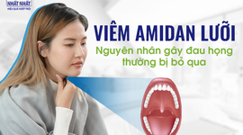Viêm amidan lưỡi: Nguyên nhân gây đau họng thường bị bỏ qua