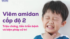 Viêm amidan cấp độ 2: Triệu chứng, tiến triển bệnh và biện pháp xử trí
