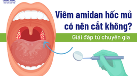 Viêm amidan hốc mủ có nên cắt không: Giải đáp từ chuyên gia