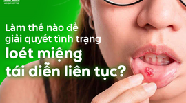 Làm thế nào để giải quyết tình trạng loét miệng tái diễn liên tục?
