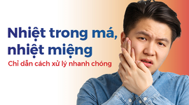 Nhiệt trong má, nhiệt miệng: Chỉ dẫn cách xử lý nhanh chóng