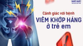Cảnh giác với bệnh viêm khớp háng ở trẻ em