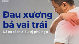 Đau xương bả vai trái: Đã có cách điều trị phù hợp