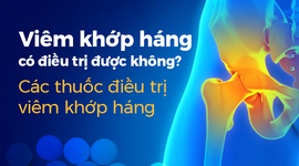 Viêm khớp háng có điều trị được không: Thuốc điều trị viêm khớp háng