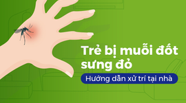 Trẻ bị muỗi đốt sưng đỏ: Hướng dẫn xử trí tại nhà