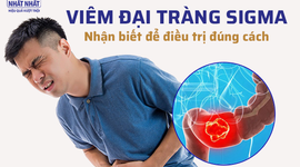 Viêm đại tràng sigma: Nhận biết để điều trị đúng cách