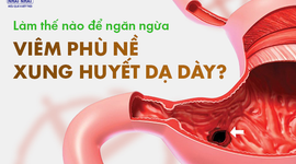 Làm thế nào để ngăn ngừa viêm phù nề xung huyết dạ dày?