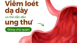 Viêm loét dạ dày có thể dẫn đến ung thư – Đừng chủ quan!